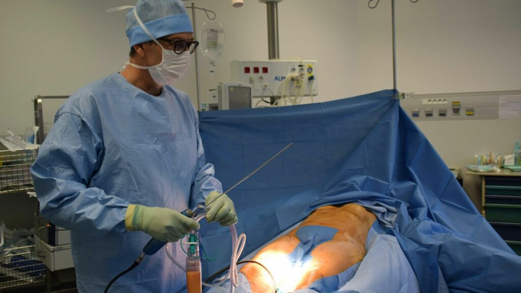 Liposuktion nicht immer nur wegen ästhetischen Gründen